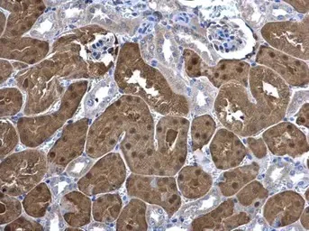 Immunohistochemistry (Formalin/PFA-fixed paraffin-embedded sections) - Anti-ketohexokinase antibody (AB154405)