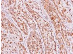 Immunohistochemistry (Formalin/PFA-fixed paraffin-embedded sections) - Anti-ketohexokinase antibody (AB154405), expandable thumbnail