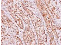 Immunohistochemistry (Formalin/PFA-fixed paraffin-embedded sections) - Anti-ketohexokinase antibody (AB154405)