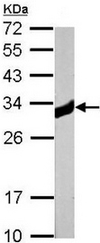 Western blot - Anti-ketohexokinase antibody (AB154405), expandable thumbnail