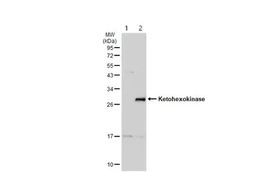 Western blot - Anti-ketohexokinase antibody (AB154405)