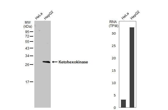 Western blot - Anti-ketohexokinase antibody (AB154405)