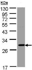 Western blot - Anti-ketohexokinase antibody (AB154405), expandable thumbnail