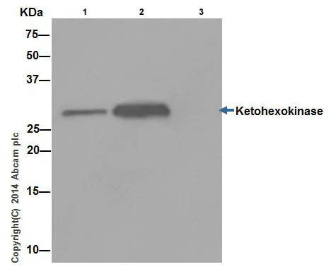 Immunoprecipitation - Anti-ketohexokinase antibody [EPR15847] (AB197593)