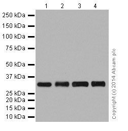 Western blot - Anti-ketohexokinase antibody [EPR15847] (AB197593), expandable thumbnail