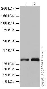 Western blot - Anti-ketohexokinase antibody [EPR15847] (AB197593)
