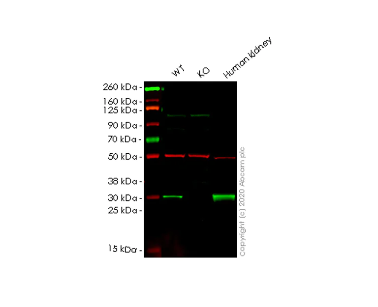 Western blot - Anti-ketohexokinase antibody [EPR15847] (AB197593)