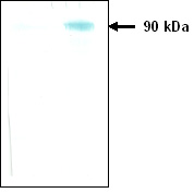 Western blot - Anti-KEX2 protease antibody [3B5] (AB34772), expandable thumbnail