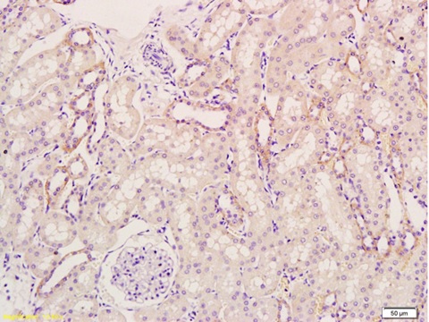 Immunohistochemistry (Formalin/PFA-fixed paraffin-embedded sections) - Anti-KGF/FGF-7 antibody (AB214178), expandable thumbnail