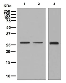 Western blot - Anti-KGF/FGF-7 antibody [EPR7261] (AB131162)