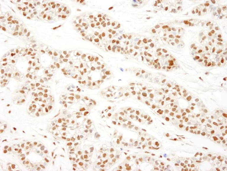 Immunohistochemistry (Formalin/PFA-fixed paraffin-embedded sections) - Anti-KHSRP antibody (AB264265)
