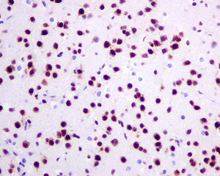 Immunohistochemistry (Formalin/PFA-fixed paraffin-embedded sections) - Anti-KHSRP antibody [EPR9864] (AB150393)
