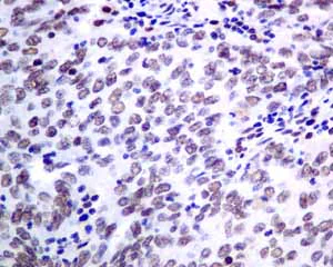Immunohistochemistry (Formalin/PFA-fixed paraffin-embedded sections) - Anti-KHSRP antibody [EPR9865] (AB140648)