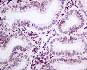 Immunohistochemistry (Formalin/PFA-fixed paraffin-embedded sections) - Anti-KHSRP antibody [EPR9865] - BSA and Azide free (AB248928)