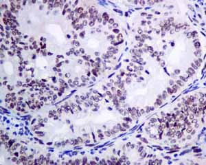 Immunohistochemistry (Formalin/PFA-fixed paraffin-embedded sections) - Anti-KHSRP antibody [EPR9865] - BSA and Azide free (AB248928)