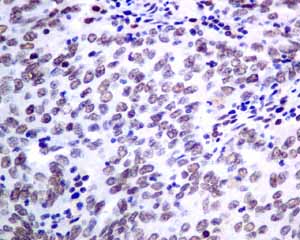 Immunohistochemistry (Formalin/PFA-fixed paraffin-embedded sections) - Anti-KHSRP antibody [EPR9865] - BSA and Azide free (AB248928)