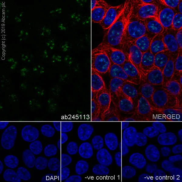 Immunocytochemistry/ Immunofluorescence - Anti-Ki67 antibody [37C7-12] (AB245113)