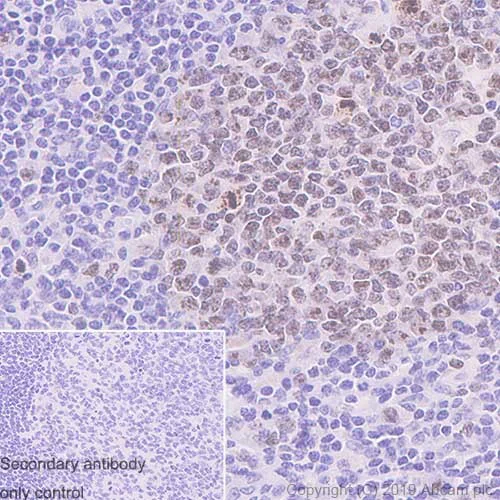 Immunohistochemistry (Formalin/PFA-fixed paraffin-embedded sections) - Anti-Ki67 antibody [37C7-12] (AB245113)