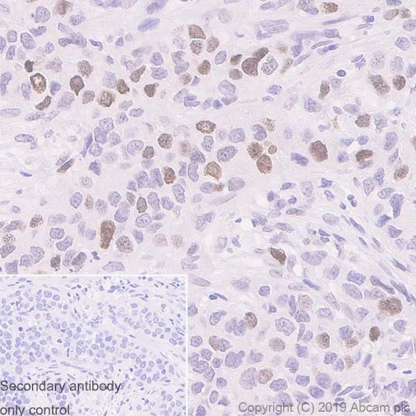 Immunohistochemistry (Formalin/PFA-fixed paraffin-embedded sections) - Anti-Ki67 antibody [37C7-12] (AB245113)