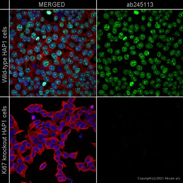 Immunocytochemistry/ Immunofluorescence - Anti-Ki67 antibody [37C7-12] - BSA and Azide free (AB252260)