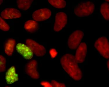 Immunocytochemistry/ Immunofluorescence - Anti-Ki67 antibody (AB15580)