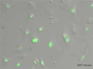 Immunocytochemistry/ Immunofluorescence - Anti-Ki67 antibody (AB15580)