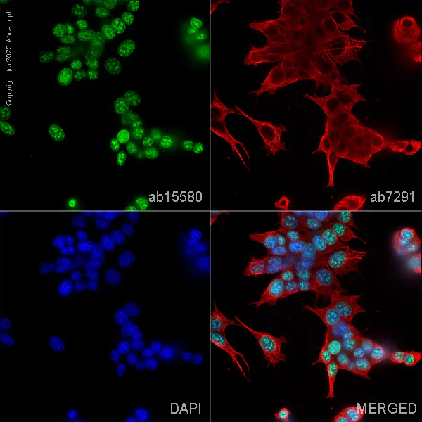 Immunocytochemistry/ Immunofluorescence - Anti-Ki67 antibody (AB15580)