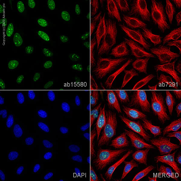 Immunocytochemistry/ Immunofluorescence - Anti-Ki67 antibody (AB15580)
