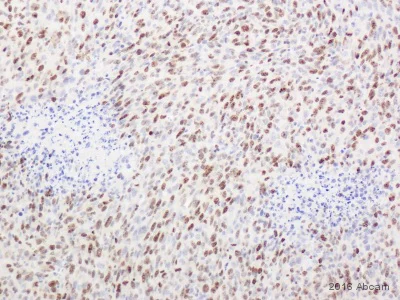 Immunohistochemistry (Formalin/PFA-fixed paraffin-embedded sections) - Anti-Ki67 antibody (AB15580)