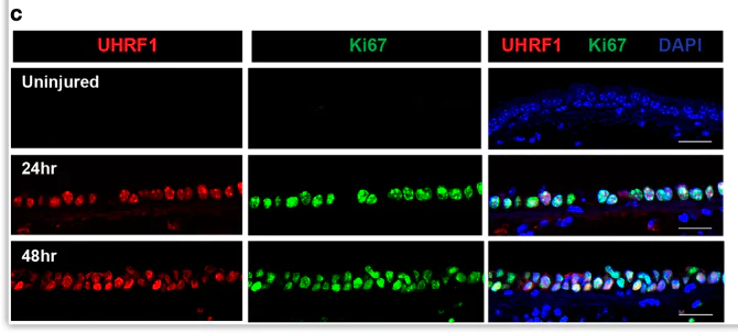 qpman　写真のKとP Anti-Ki67 antibody - biomarker, KO validated (ab15580) | Abcam