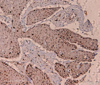 Immunohistochemistry (Formalin/PFA-fixed paraffin-embedded sections) - Anti-Ki67 antibody (AB15580)