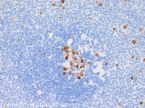 Immunohistochemistry (Formalin/PFA-fixed paraffin-embedded sections) - Anti-Ki67 antibody (AB15580)