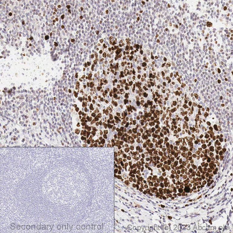 Anti-Ki67 antibody - biomarker, KO validated (ab15580) | Abcam