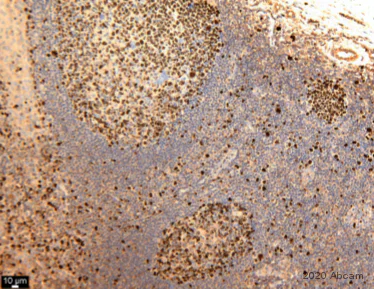 Immunohistochemistry (Formalin/PFA-fixed paraffin-embedded sections) - Anti-Ki67 antibody (AB15580)