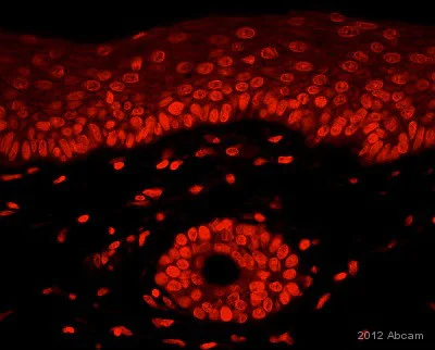 Immunohistochemistry (Formalin/PFA-fixed paraffin-embedded sections) - Anti-Ki67 antibody (AB15580)