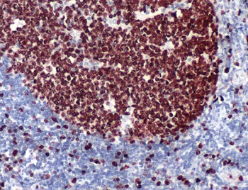 Immunohistochemistry (Formalin/PFA-fixed paraffin-embedded sections) - Anti-Ki67 antibody (AB230460)