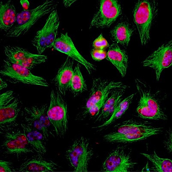 Immunocytochemistry - Anti-Ki67 antibody (AB254123), expandable thumbnail