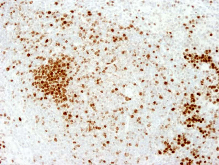 Immunohistochemistry (Formalin/PFA-fixed paraffin-embedded sections) - Anti-Ki67 antibody (AB264429)