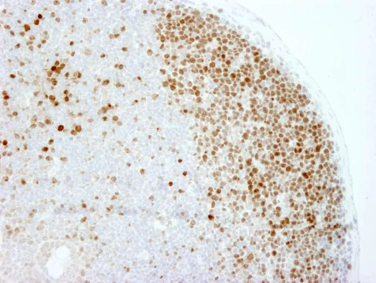 Immunohistochemistry (Formalin/PFA-fixed paraffin-embedded sections) - Anti-Ki67 antibody (AB264429)