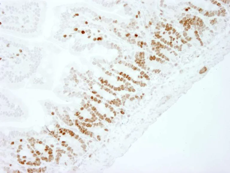 Immunohistochemistry (Formalin/PFA-fixed paraffin-embedded sections) - Anti-Ki67 antibody (AB264429)