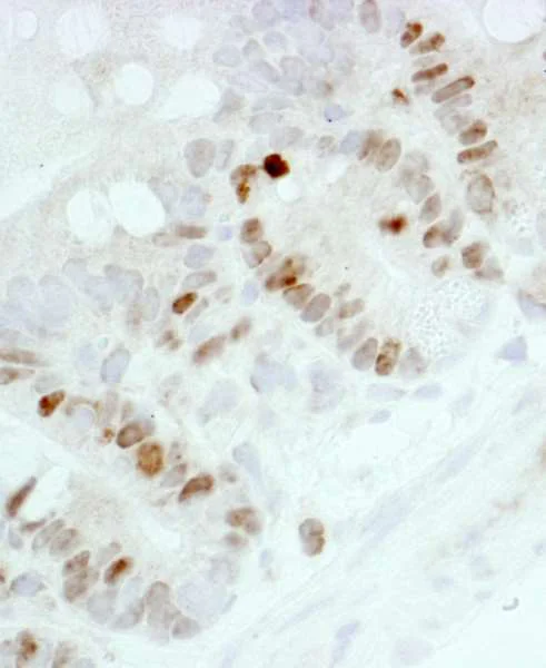 Immunohistochemistry (Formalin/PFA-fixed paraffin-embedded sections) - Anti-Ki67 antibody (AB264429)