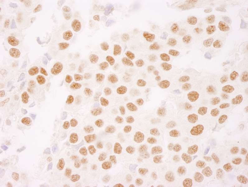 Immunohistochemistry (Formalin/PFA-fixed paraffin-embedded sections) - Anti-Ki67 antibody (AB264430)