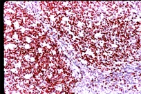 Immunohistochemistry (Formalin/PFA-fixed paraffin-embedded sections) - Anti-Ki67 antibody (AB833)