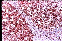 Immunohistochemistry (Formalin/PFA-fixed paraffin-embedded sections) - Anti-Ki67 antibody (AB833)