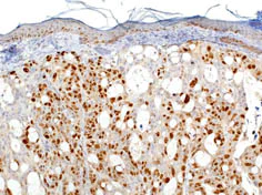 Immunohistochemistry (Formalin/PFA-fixed paraffin-embedded sections) - Anti-Ki67 antibody (AB833)
