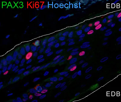 Immunohistochemistry (Formalin/PFA-fixed paraffin-embedded sections) - Anti-Ki67 antibody (AB833)
