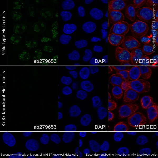 Immunocytochemistry/ Immunofluorescence - Anti-Ki67 antibody [B56] (AB279653)