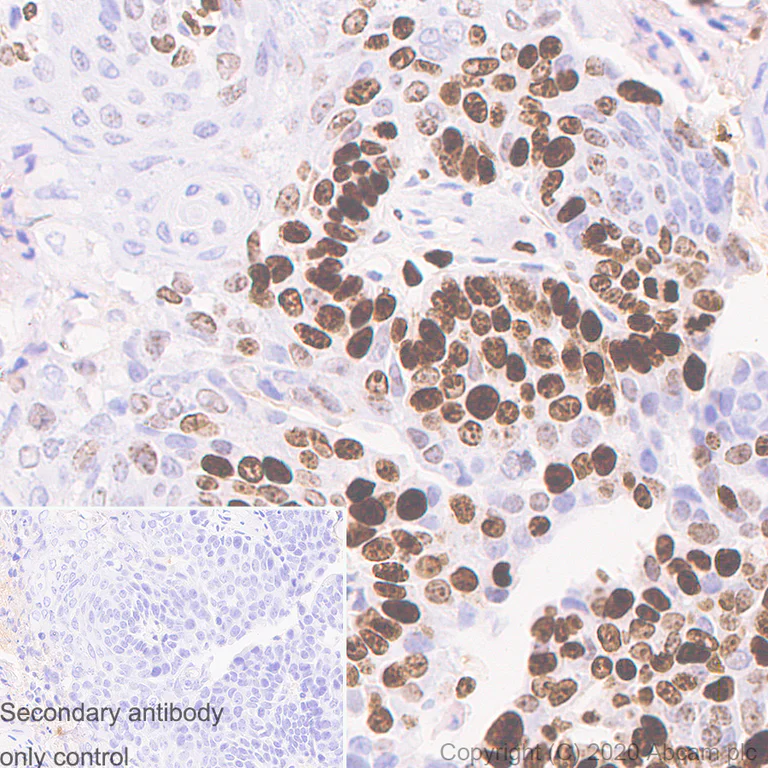 Immunohistochemistry (Formalin/PFA-fixed paraffin-embedded sections) - Anti-Ki67 antibody [B56] (AB279653)