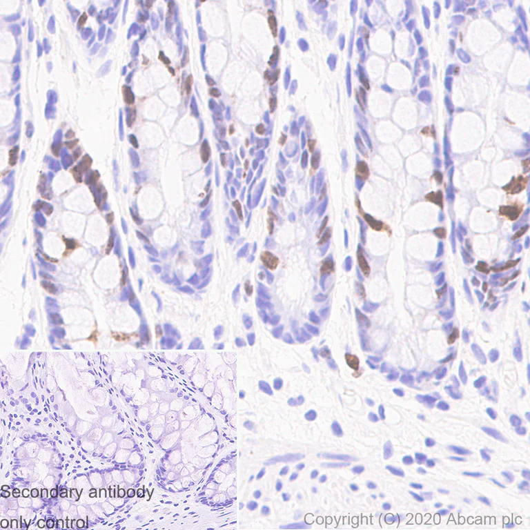 Immunohistochemistry (Formalin/PFA-fixed paraffin-embedded sections) - Anti-Ki67 antibody [B56] (AB279653)
