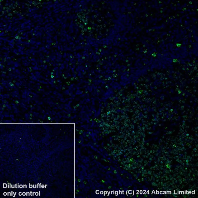 Immunohistochemistry (Formalin/PFA-fixed paraffin-embedded sections) - Anti-Ki67 antibody [B56] (AB279653)